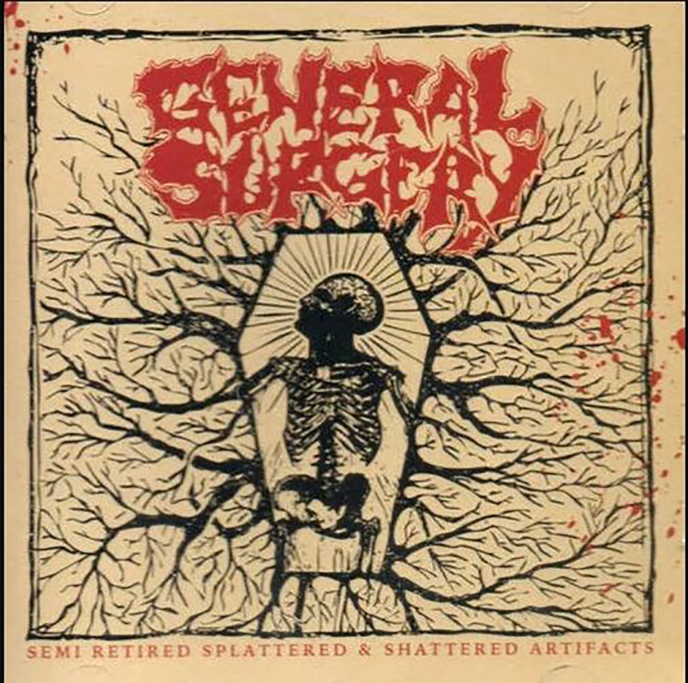 GENERAL SURGERY - semi retired splattered & shattered artifacts CD